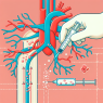 Injection de stanozolol dans le système cardiovasculaire.